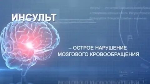 Школа инсульта