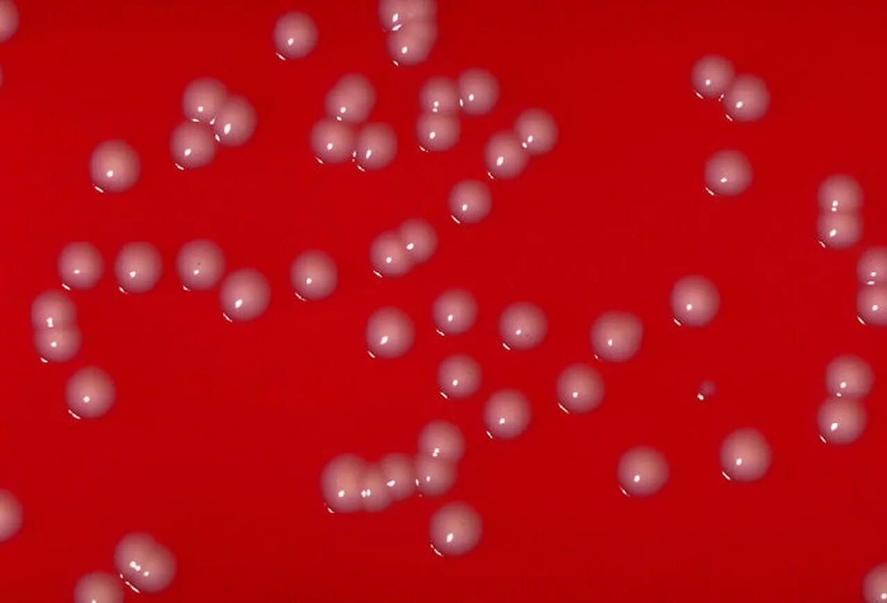 Corynebacterium spp в мазке у мужчин