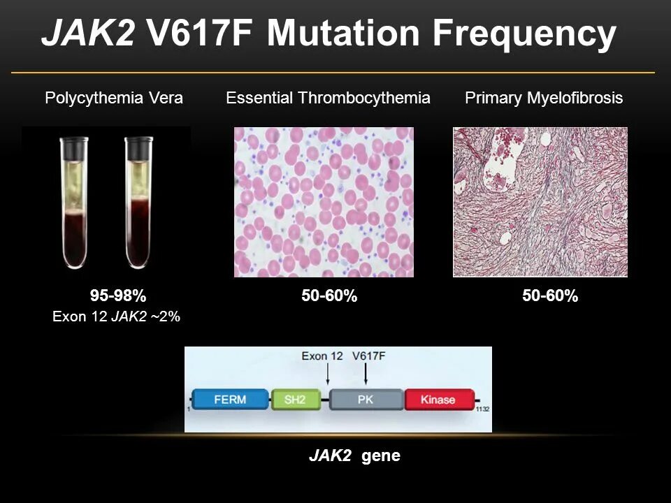 Global mutation. Мутация jak2 v617f что это. V617f в гене jak2. Jak 2 мутация. Обнаружена мутация Гена jak2 v617f.