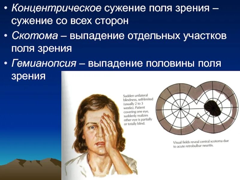 Исчезнуть из поля зрения бывшей. Концентрическое сужение полей зрения. выпадение полей зрения.
