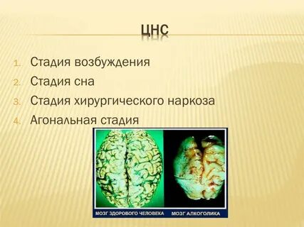 Мозг здорового человека