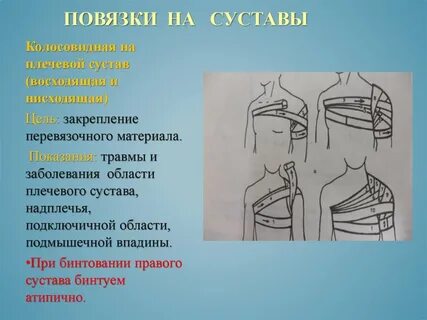 Показания к наложению повязок
