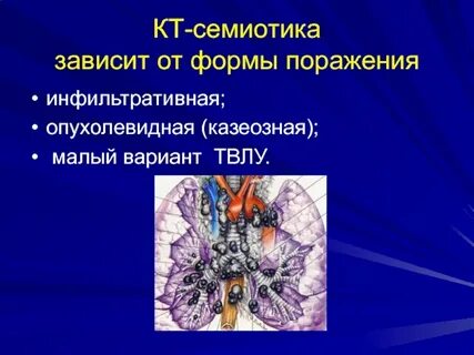 Семиотика поражения