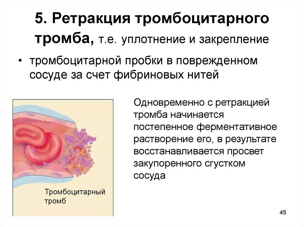 Уплотнение тромба. Ретракция тромбоцитов механизм. Ретракция тромбоцитарного тромба. Ретракция тромбоцитарного сгустка. Ретракции сгустка крови.