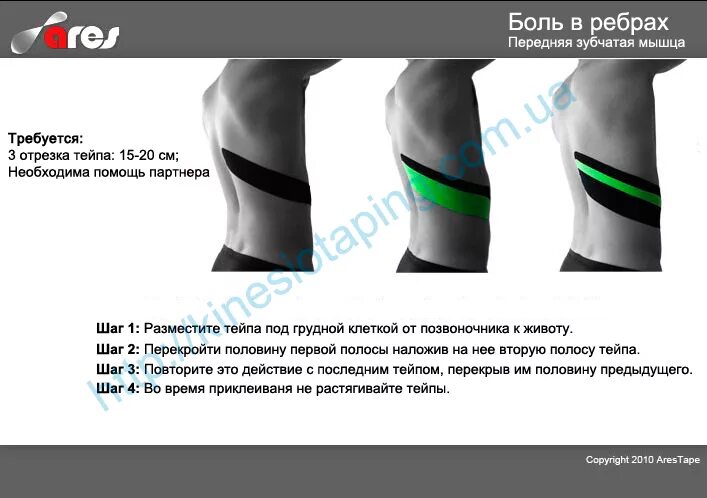 Кинезио тейп межреберная невралгия. Межреберная невралгия тейпирование грудной клетки. Тейпирование ребер при невралгии. Тейпы при межреберной невралгии. Межреберная невралгия тейпирование.