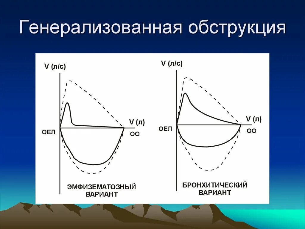Показатели спирометрии при обструкции. Кривая поток объем на спирометрии. Поток объем спирография. Спирография обструкция. Спирограмма при бронхиальной астме.