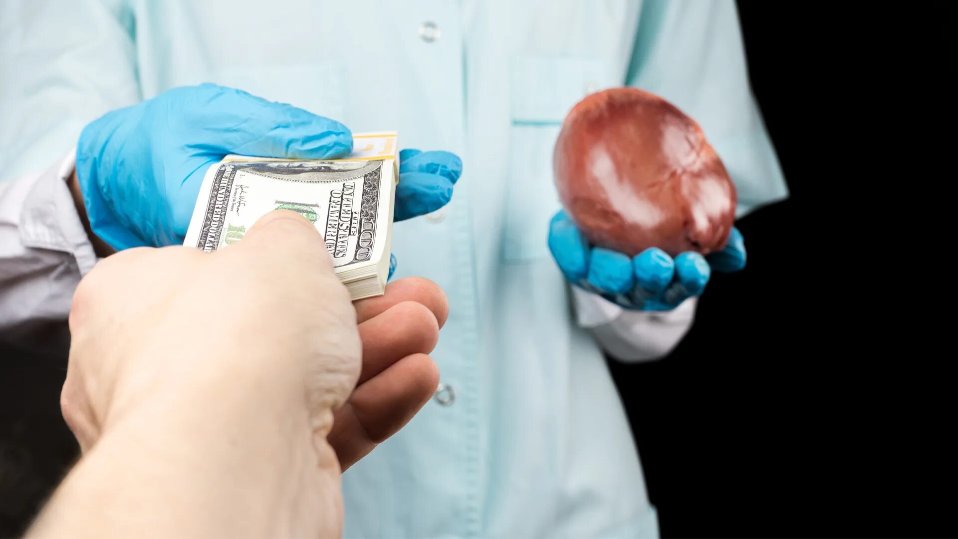 Продать почку донор