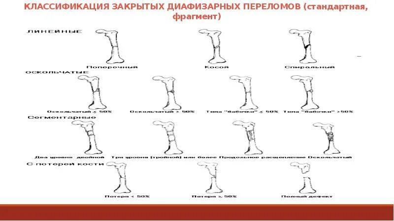 Классификация трещин. Классификация диафизарных переломов. Классификация закрытых переломов. Классификация переломов ao/Asif. Классификация открытых диафизарных переломов Каплан.