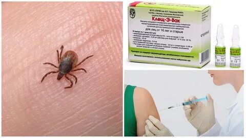 Прививка от клещевого энцефалита когда можно мыться
