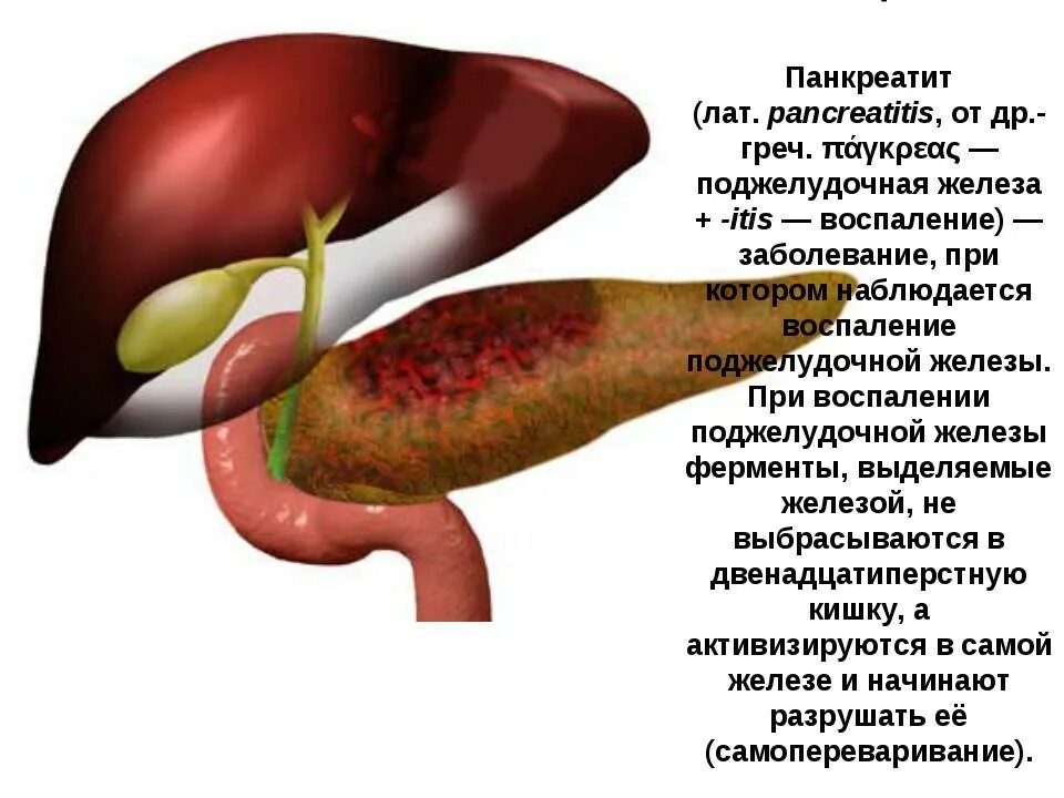 Хронический панкреатит печени