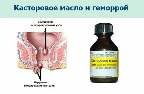 Банальная трещина по утвержденным клиническим