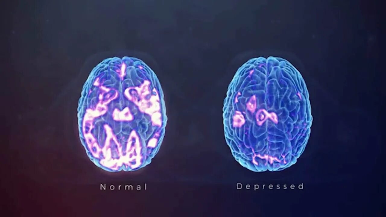 The brain 12. Кристальный мозг. brain depression. тмс нейрофизиология. brain stimulation игра.