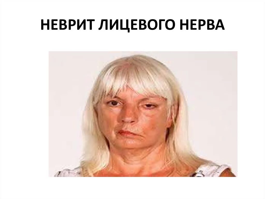 Лицевой информация
