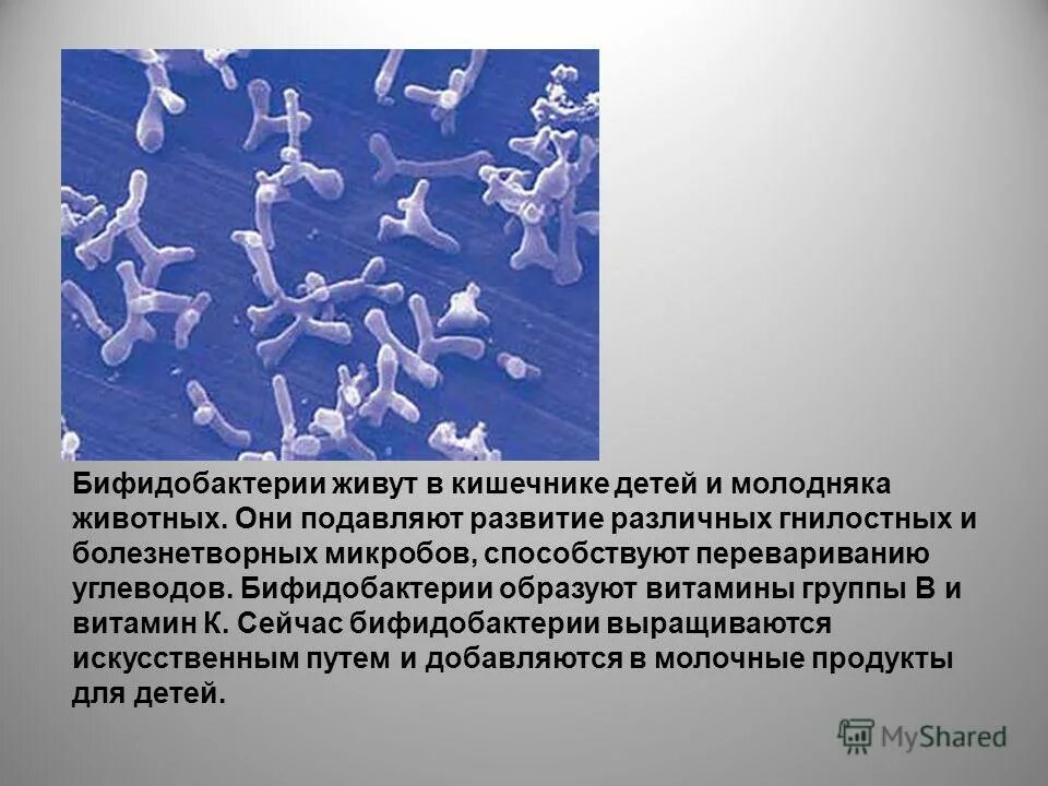 Какие бифидобактерии. Бифидобактерии бифидум микроорганизмы. Бифидобактерии строение. Строение бифидобактерий. Бифидобактерии описание.