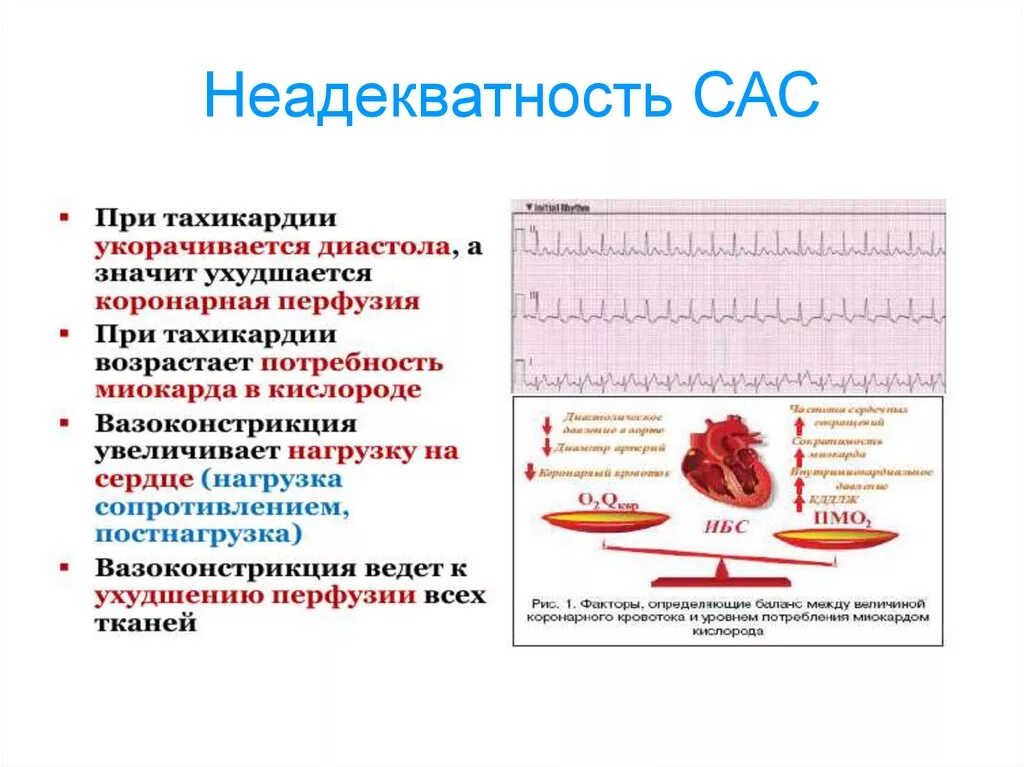 Сас в медицине