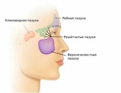 Киста правого верхней челюстной пазухи