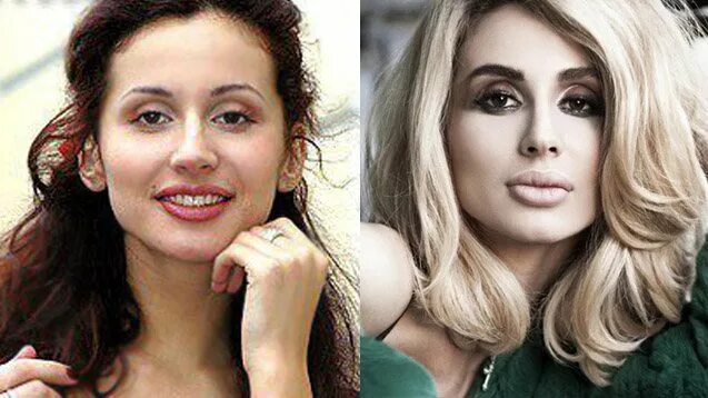 Светлана до и после пластики фото Как выглядела "суперзвезда" Светлана Лобода до пластики: совсем другой человек о