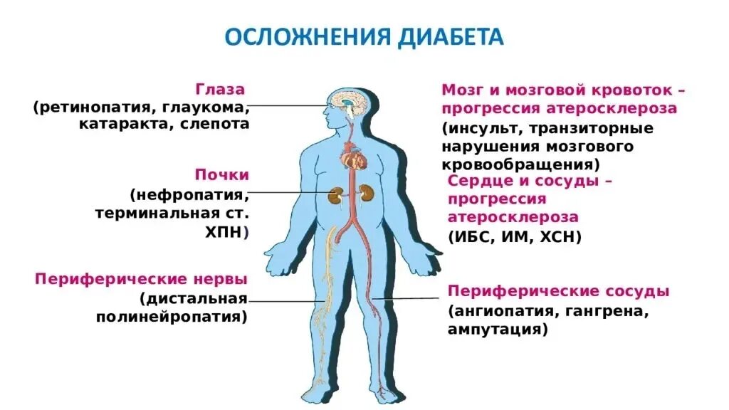 Осложнения СД 1 типа. Осложнения СД 2 типа. Осложнения сахарного диабета 2 типа. Осложнения при СД 1 И 2 типа.