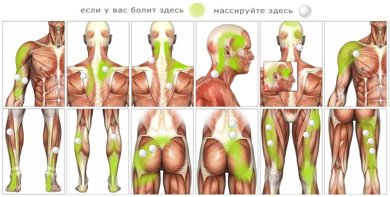 Лечение триггерных мышц