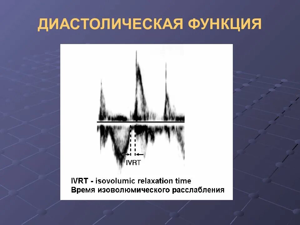 Оценка диастолической функции лж по ЭХОКГ. Псевдонормальный Тип диастолической функции. Диастолическая функция левого желудочка. Типы диастолической дисфункции ЭХОКГ.