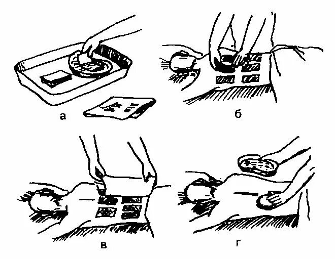 Температура воды для смачивания горчичников. Техника постановки горчичников алгоритм. Постановка горчичников алгоритм. Алгоритм проведения постановки горчичников. Алгоритм постановки горчичников пациенту.