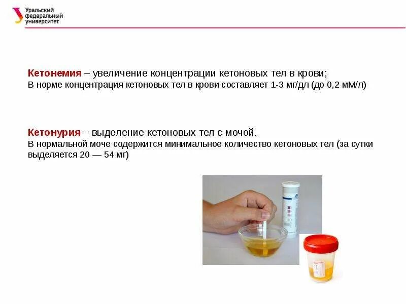 Кетоновый белок в моче. Содержание кетоновых тел в норме. Кетоновые тела в крови. Кетоновые тела методы определения кетоновых тел. Концентрация кетоновых тел в крови в норме.