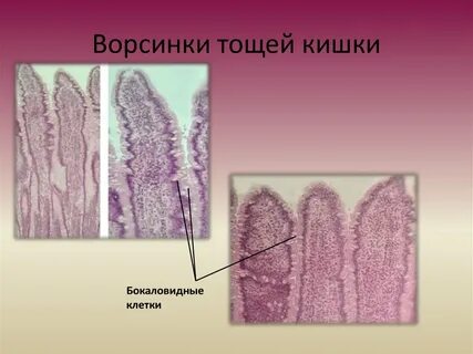 Наличие в слизистой оболочке многочисленных ворсинок