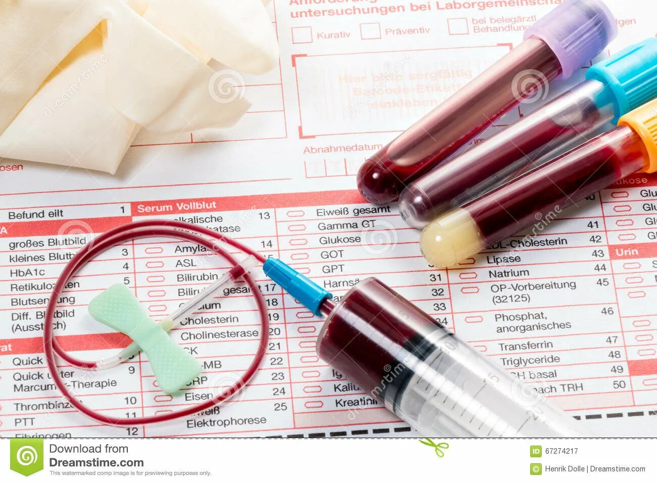 Анализ крови. Анализ крови лаборатория. Анализ картинка. Анализ крови без фона. Выезд анализ крови