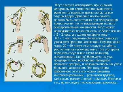 При артериальном кровотечении сколько можно держать жгут