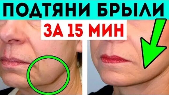 Птоз нижней трети лица. Брыли подтянуть овал. Брыли подтянуть овал. Упражнения от брылей на лице. Брыли (лифтинг нефертити).