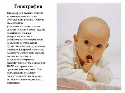 Гипостатура это