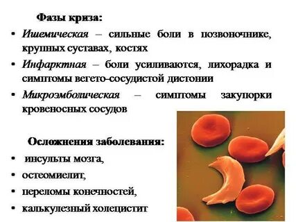 Серповидно клеточная заболевание