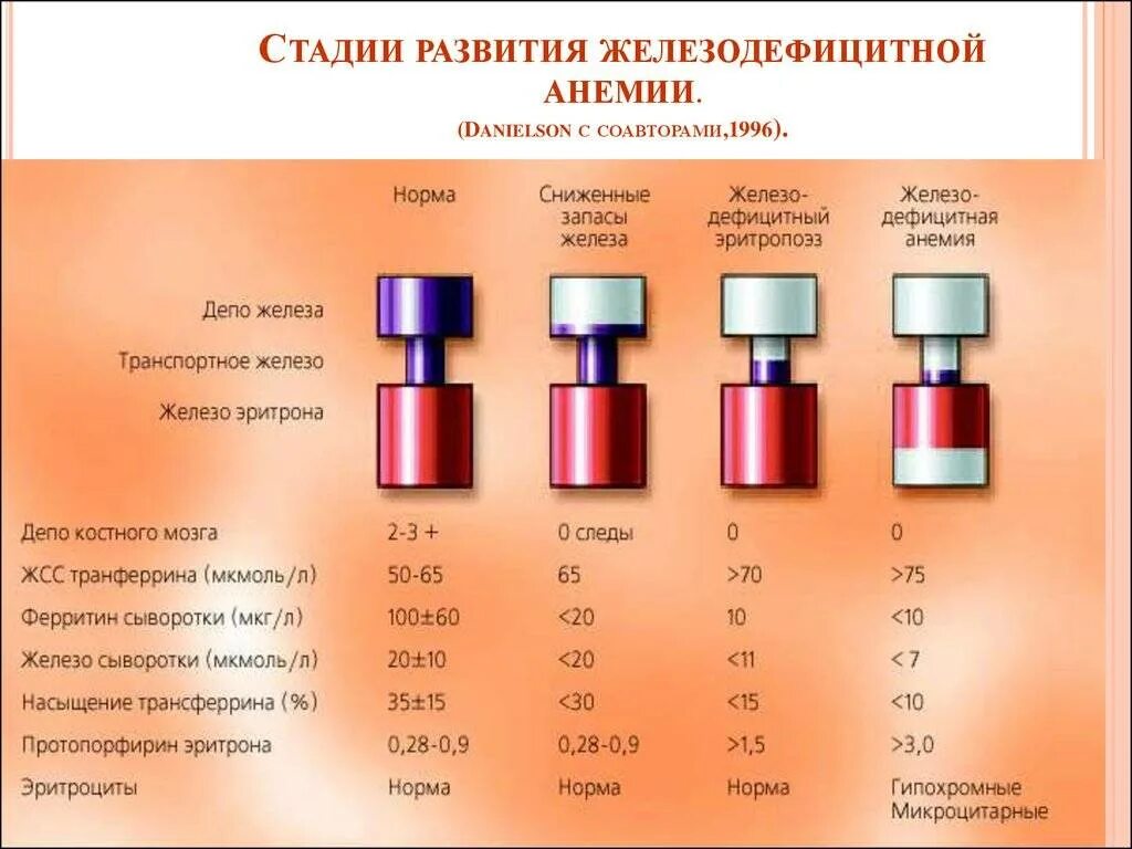 Гемоглобин 50 у мужчины причины. Ферритин при железодефицитной анемии у детей норма. Показатели крови при жда у детей. Показатели железа в крови при анемии. Гемоглобин при железодефицитной анемии показатели.