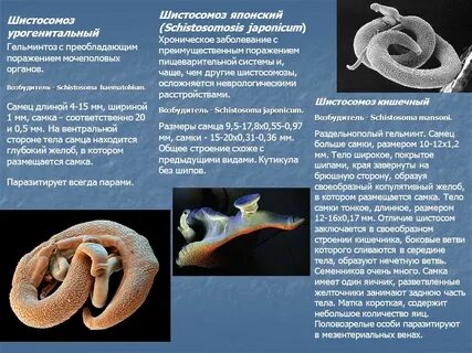 Шистосамоз