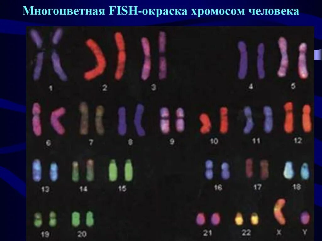 Хромосомные мутации методы генетики. Кариотипирование хромосом человека. Цитогенетический метод кариотип человека. Цитогенетический метод метафаза. Метод Fish генетика окрашивание хромосом.