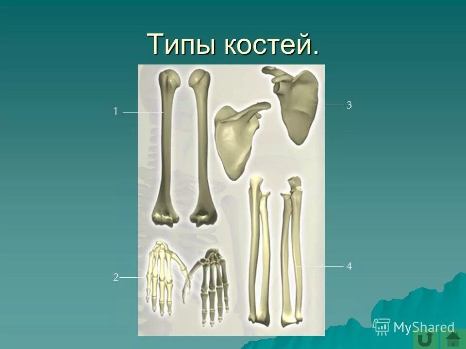 Трубчатые кости скелета. Таблица тип строение кости. Типы строения костей. Виды костей человека таблица. Трубчатые губчатые плоские кости таблица.