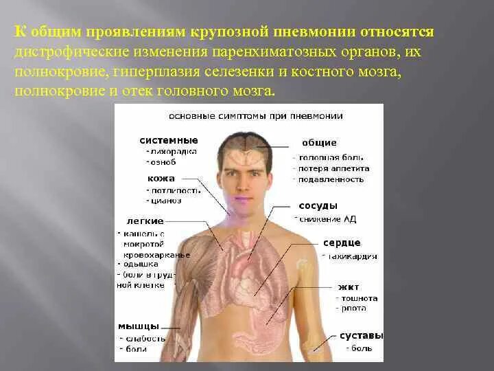 Проявление крупозной пневмонии. Больной крупозной пневмонией. Лицо больного крупозной пневмонией. Крупозная пневмония пациент.