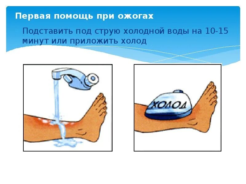 Первая помощь при ожогах. Первый помочь при ожоге. Ожог кипятком что делать первая помощь