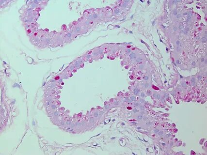 Pathology outlines