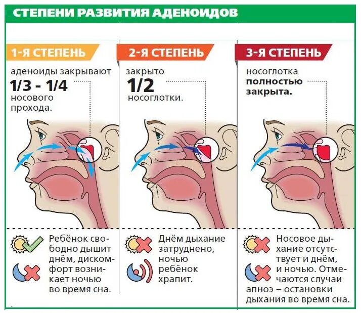Нос не дышит и течет