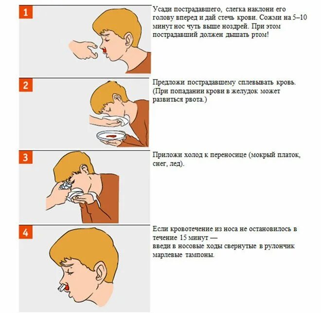 Алгоритм помощи при носовом. Как быстро остановить кровь. как остановить кровь в домашних условиях быстро. оказание первой помощи в школе. как в домашних условиях остановить.