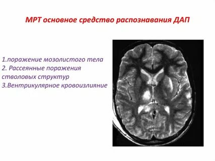 Поражение вещества головного мозга