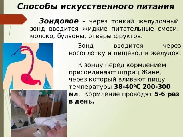 Как кормят через зонт