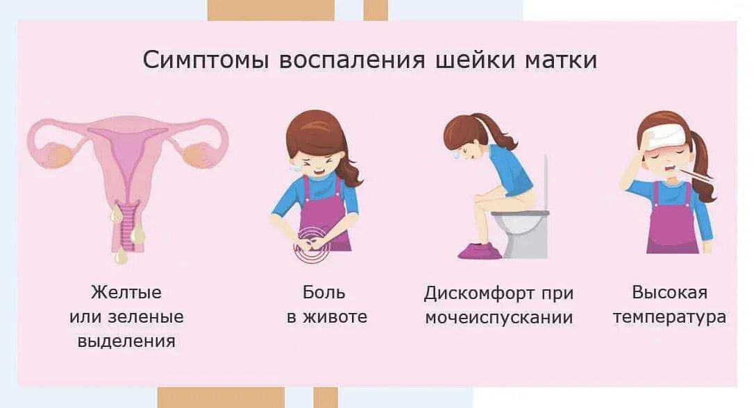 Какие выделения при раке шейки. Шейка матки это дисплазия симптомы. симптомыдисплазии шейкиматуи. клинические проявления шейки матки.