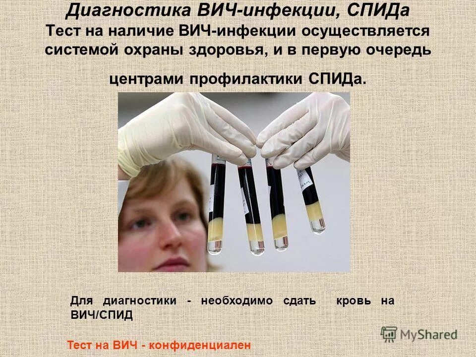 Спид вопросы и ответы. Тесты по вич инфекции. Эпидемический критерий. Тесты по вич инфекции. Принципы лабораторной диагностики вич-инфекции.