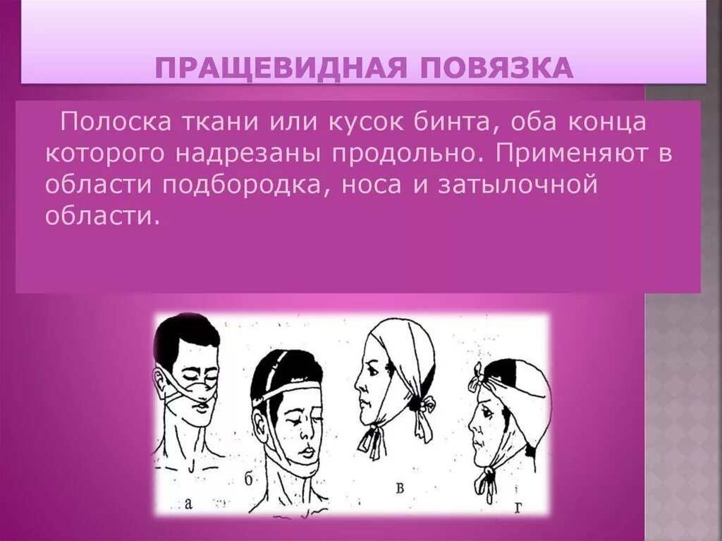 Техника наложения пращевидной повязки. Пращевидная повязка накладывается на. Десмургия пращевидная повязка. Пращевидная повязка применяется. Виды повязок пращевидная.