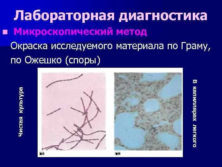 Окраска спор бактерий. Метод окраски спор по Ожешко. Микроскопический метод методы окраски. Окраска по методу Ожешко микробиология. Сибирская язва окраска по Ожешко.