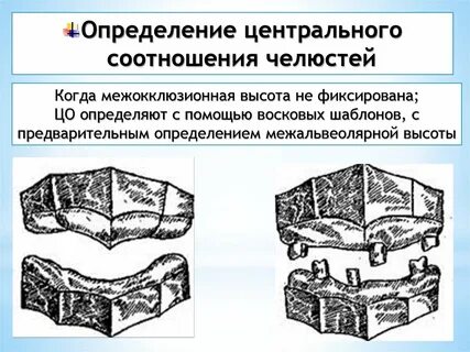 Этапы определения центрального соотношения