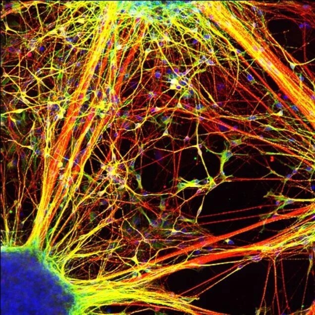 Нейронные микросети. Клетки головного мозга. Нейронная клетка. Нейроны головного мозга под микроскопом.