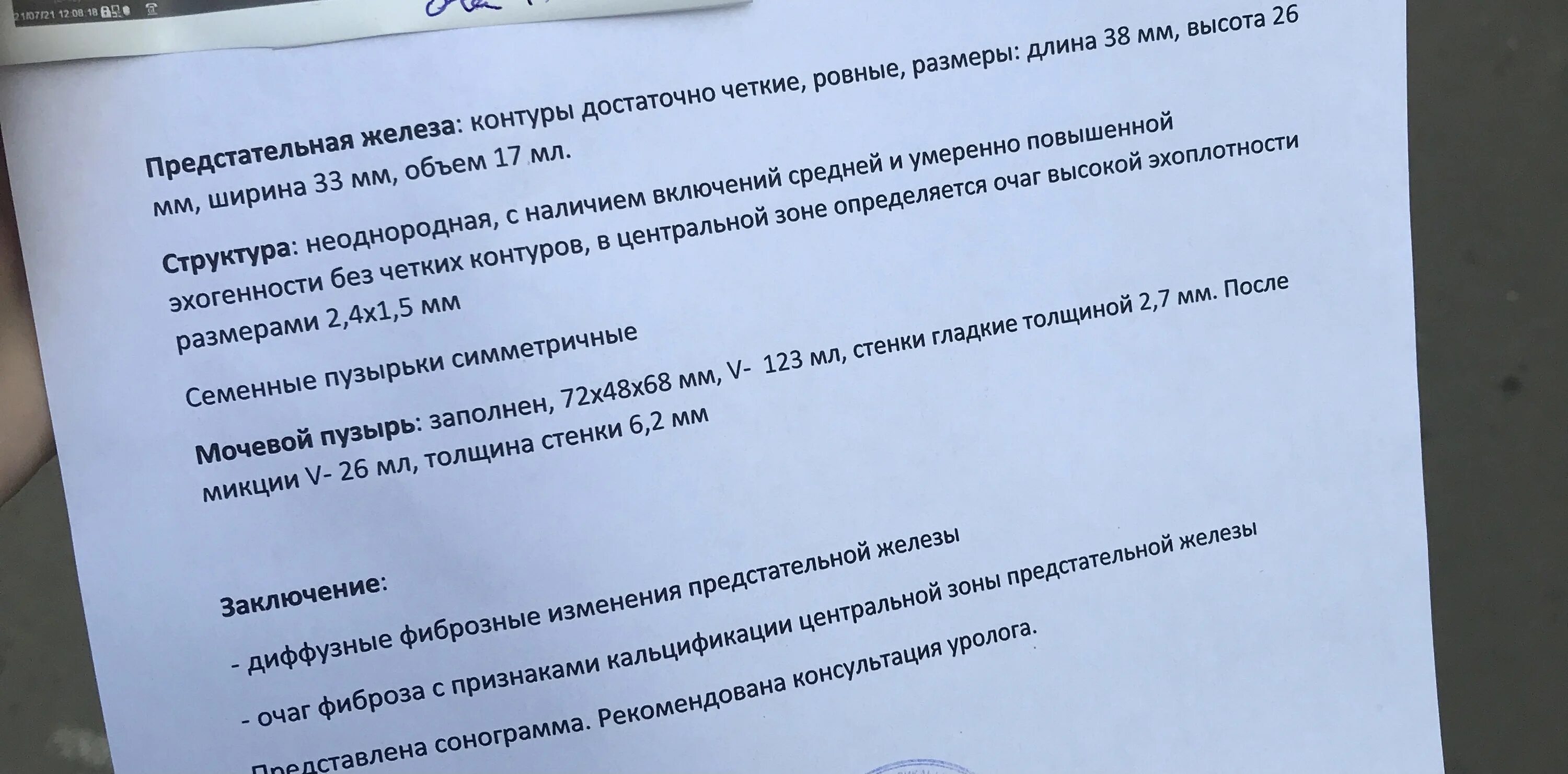 Фиброз простаты что это такое. Фиброз простаты что это такое